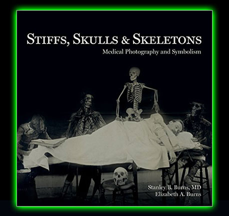Stiffs, Skulls & Skeletons: Medical Photography and Symbolism 1st Edition