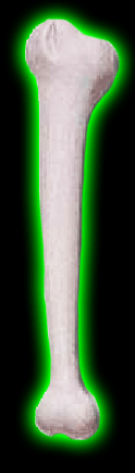 Plastic Bone
