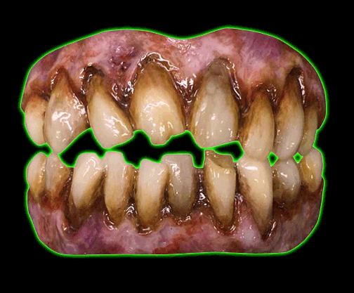 Zombie Horror Teeth